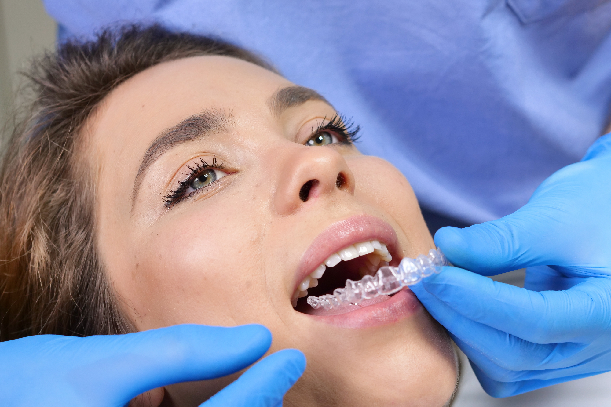 Zobozdravnik in nevidni zobni aparat