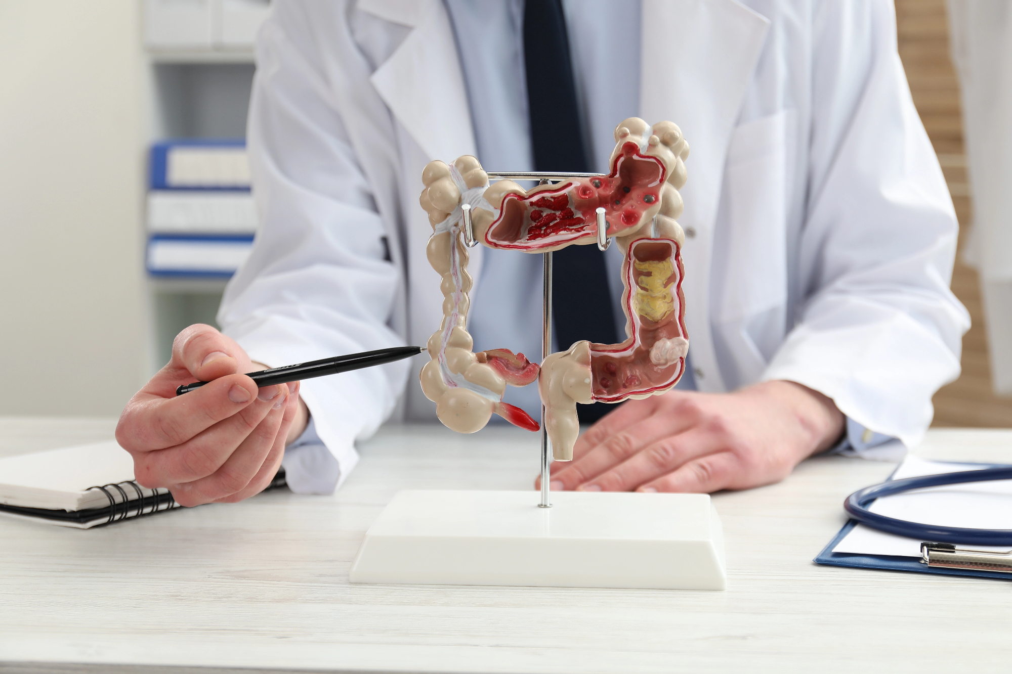Gastroenterolog mi je pomagał razumeti, kaj se dogaja v mojem telesu